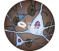 Brain nerve neuron cells damage zoom - Edit and Customize Icons of Brain nerve neuron cells damage zoom Brain nerve neuron cells damage zoom Icons, Symbols, Pictures, and Images