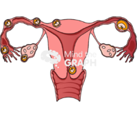 Ectopic pregnancies - Edit and Customize Icons of Ectopic pregnancies Ectopic pregnancies Icons, Symbols, Pictures, and Images