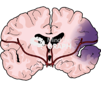 Human brain blood injury front cut 2 - Edit and Customize Icons of Human brain blood injury front cut 2 Human brain blood injury front cut 2 Icons, Symbols, Pictures, and Images