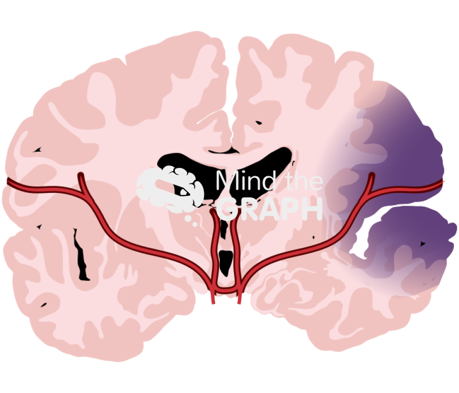 Human brain blood injury front cut 2 Icons, Symbols, Pictures, and Images