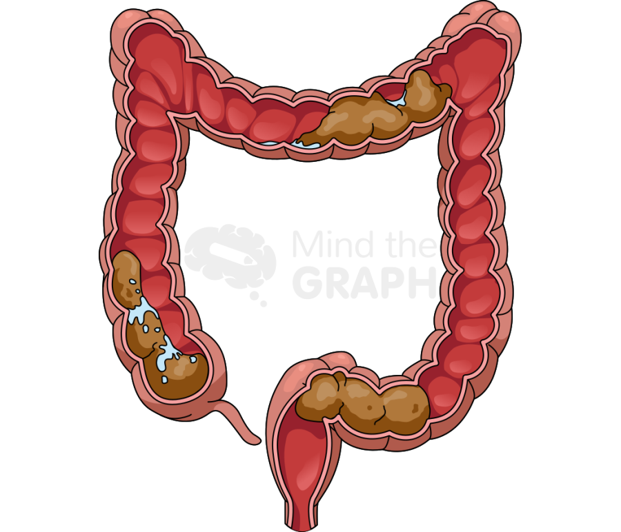 Intestine large cut stool Icons, Symbols, Pictures, and Images