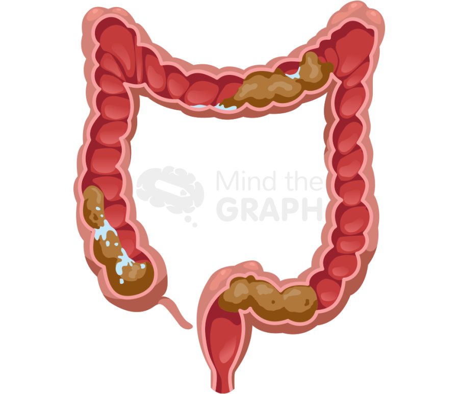 Intestine large cut stool Icons, Symbols, Pictures, and Images