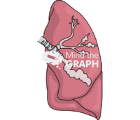 Lung bronchiectasis - Edit and Customize Icons of Lung bronchiectasis Lung bronchiectasis Icons, Symbols, Pictures, and Images