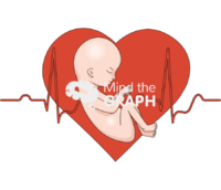 Pregnancy cardiovascular ecg baby - Edit and Customize Icons of Pregnancy cardiovascular ecg baby Pregnancy cardiovascular ecg baby Icons, Symbols, Pictures, and Images