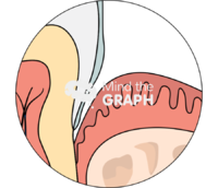 Teeth oral mucosa zoom - Edit and Customize Icons of Teeth oral mucosa zoom Teeth oral mucosa zoom Icons, Symbols, Pictures, and Images