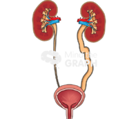 Urinary system megaureter cut - Edit and Customize Icons of Urinary system megaureter cut Urinary system megaureter cut Icons, Symbols, Pictures, and Images
