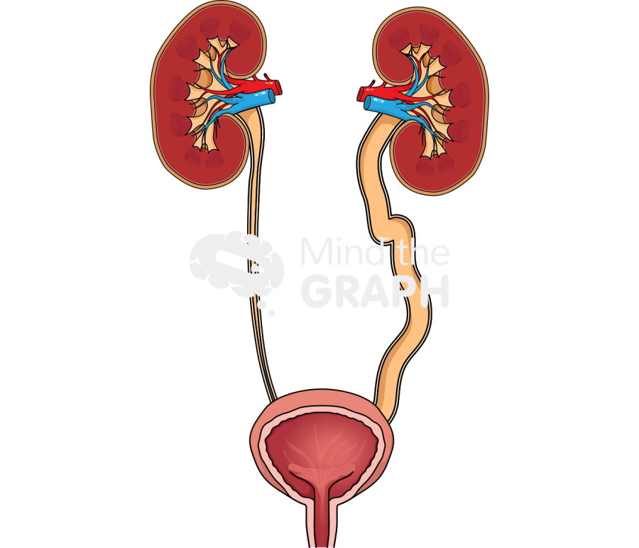 Urinary system megaureter cut Icons, Symbols, Pictures, and Images