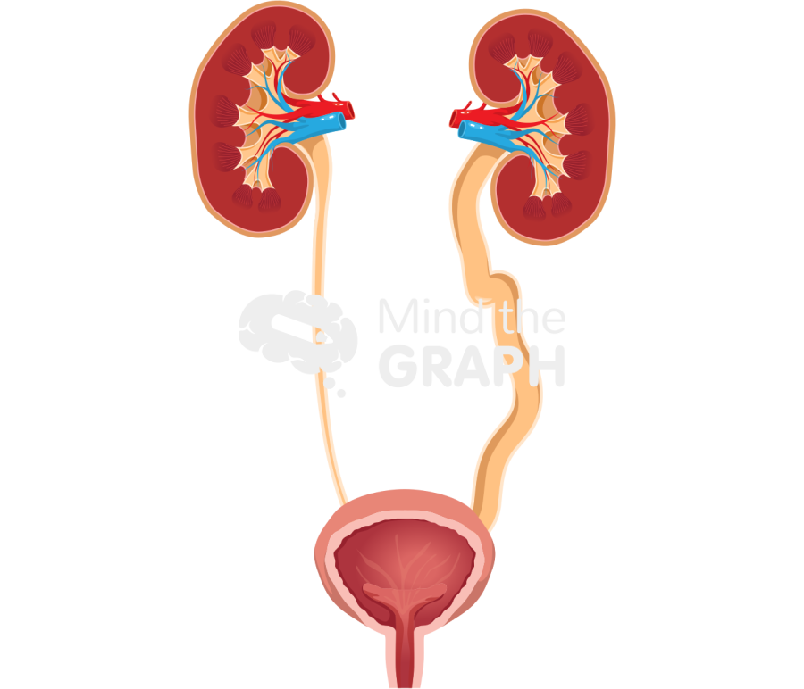 Urinary system megaureter cut Icons, Symbols, Pictures, and Images