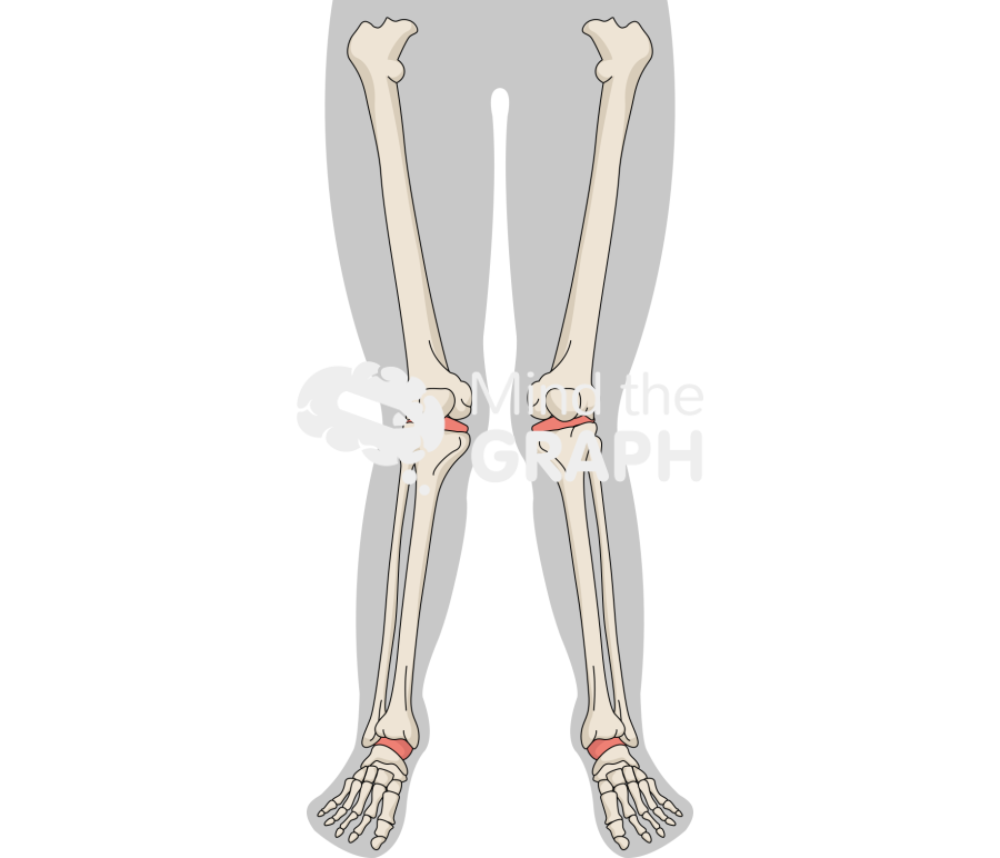 Valgus knees body Icons, Symbols, Pictures, and Images